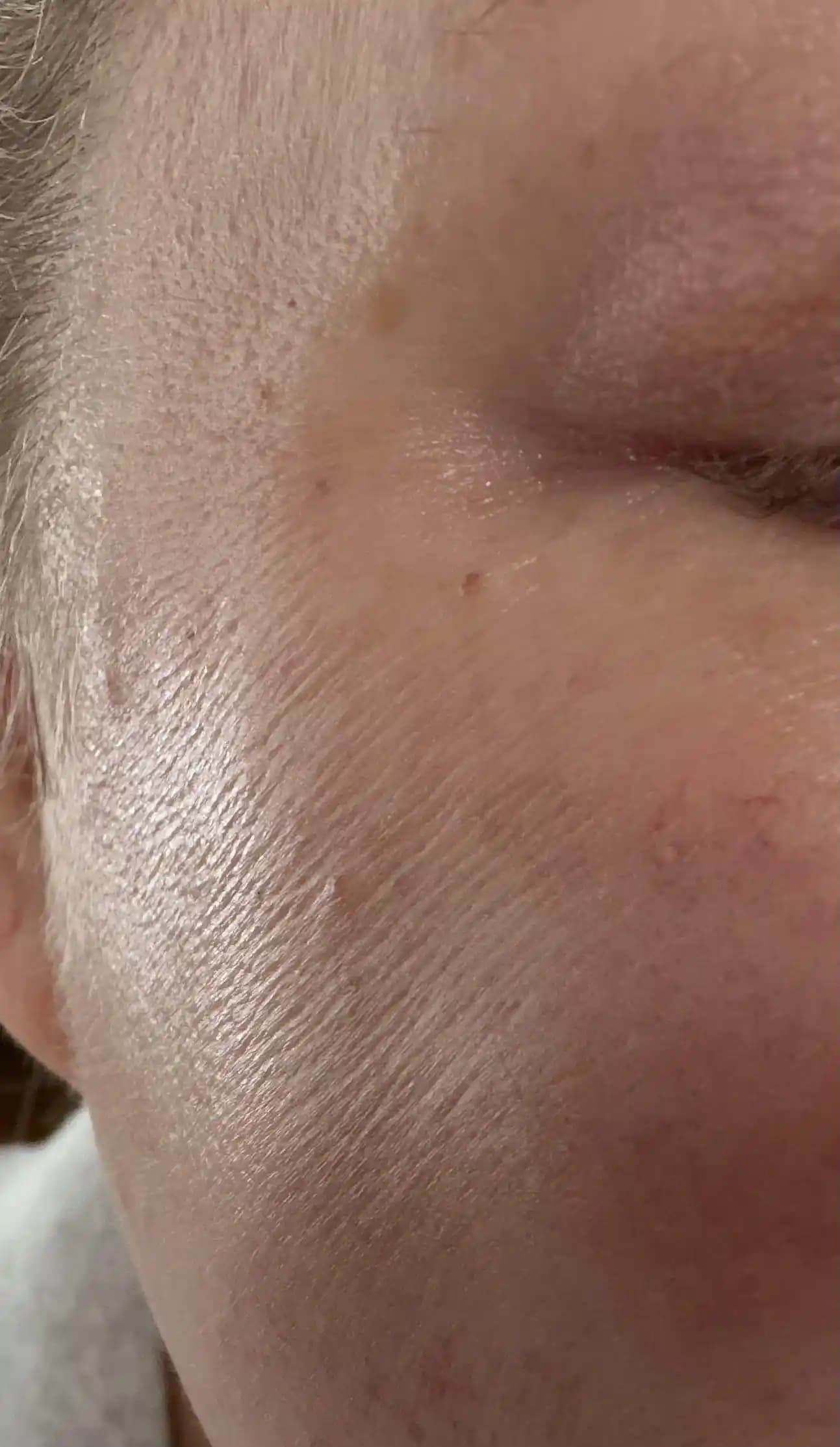 Yüz ve Vücutta İnce Çizgilerin Nedenleri ve Etkili Cilt Bakım Yöntemleri