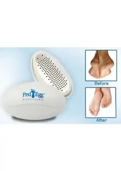 Ayak Bakımı İçin Pratik ve Etkili Magic Gift Ped Egg Topuk Törpüsü Özellikleri