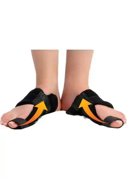 Markaflex Gece Ateli ile Ayak Başparmak Kemiği Çıkıntısı ve Deformitelerin Tedavisi