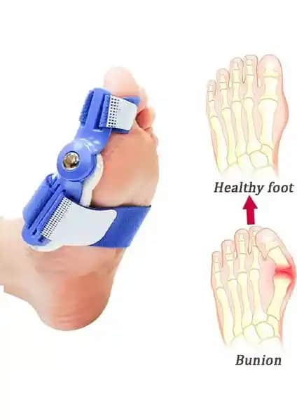 Silimo Ayak Baş Parmak Düzeltici Halluks Valgu Gece Ateli Ürünü İncelemesi ve Kullanım Rehberi